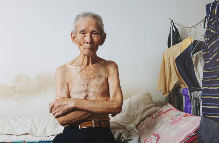 黃子明的《韓戰反共戰俘的政治紋身》揭示韓戰後來臺的「反共義士」在歷史洪流中的身體痕跡。他們大多在戰俘營因各自不同原因或立場刺上了反共標語。這些刺青使他們與親人長期分離，而在開放探親後，又必須以雷射、手術或藥劑殘酷地去除，留下新的傷痕。皮膚成了意識形態與權力的看板，也是情感斷裂的見證。黃子明，〈韓戰反共戰俘的政治紋身：唐子林〉，2013。國家攝影文化中心典藏。